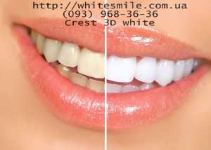  crest 3d whiteWhitestrips crest whitestrips,.