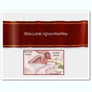 Массаж простаты. Урологический массаж. Профессионально - объявление