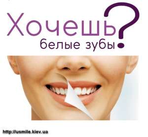 Хочешь белые зубы? - объявление